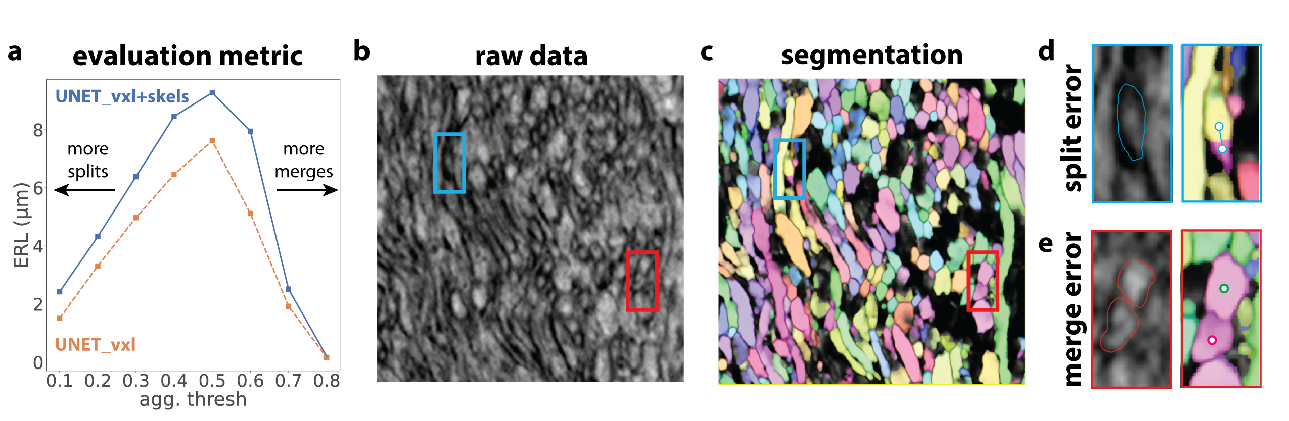 XPRESS: Xray Projectomic Reconstruction - Extracting Segmentation with ...